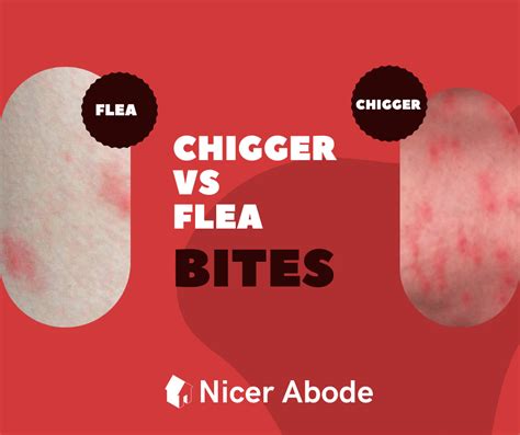 Chigger Bites vs Flea Bites: Which One Is It?