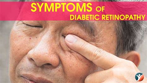 Diabetic Retinopathy - Causes, Risks, Prevention & Treatment