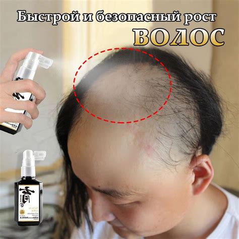 концентрат бустер для роста волос/Спрей для роста волос,для густоты, от ...