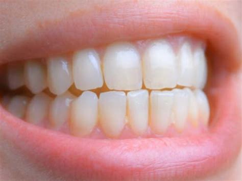 Правильний прикус у людини: фото зубів | Dental Art