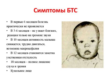 Синдром Тея-Сакса - презентация онлайн