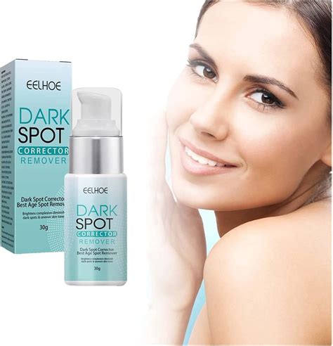 Amazon.com: 2023 New Dark Spot Remover Cream for Face, Musely Dark Spot ...