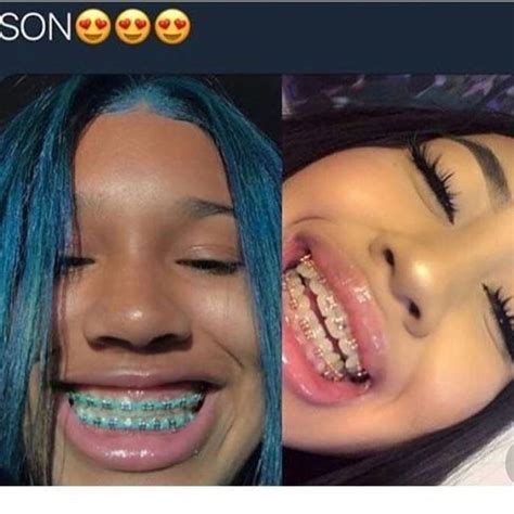 braces color  dark skins  william foxworth blog