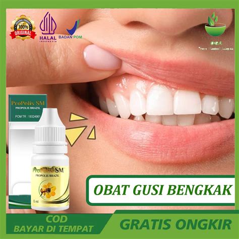 jual obat gusi bengkak sakit gigi perontok gigi berlubang peradangan
