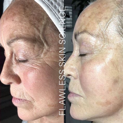 Home [www.flawlessskinscience.com.au]