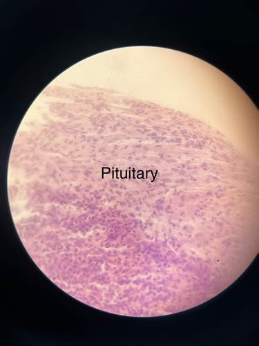 The Endocrine System Flashcards | Quizlet