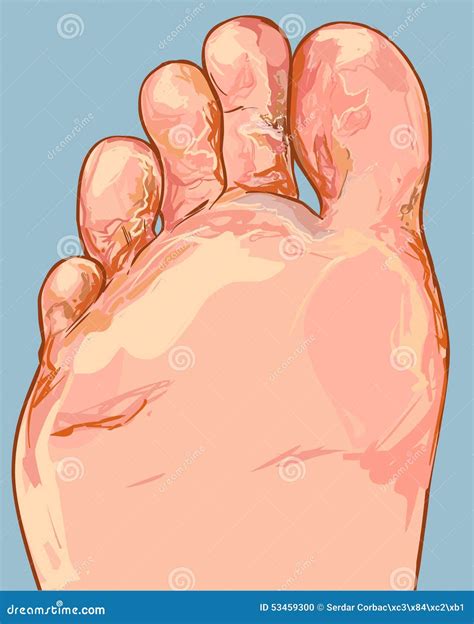 Athlete s foot stock vector. Illustration of mankind - 53459300