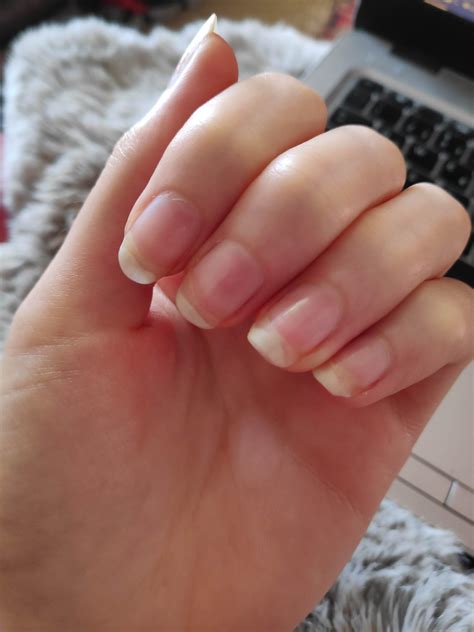 Are White Fingernails Normal at Ellen Curry blog