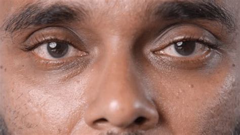Many People Open Eyes Close Multi Stock Footage Video (100% Royalty ...