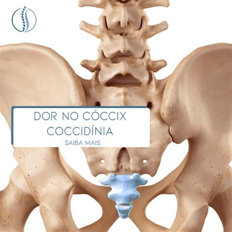 Ferida No Cóccix O Que Pode Ser - Dor no Cóccix – Coccidínia – Causas, Sintomas e Tratamento – Dr. João ...