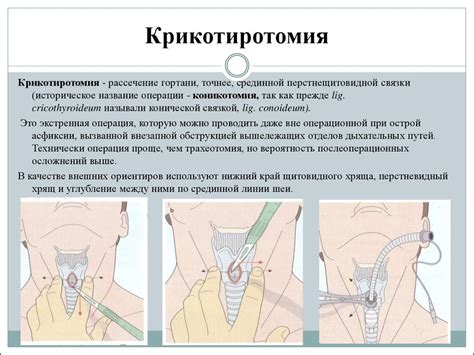 Операции в области шеи - online presentation
