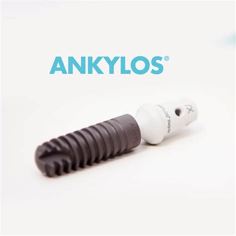 Импланты Анкилоз: цены, отзывы о системе Ankylos в СПб
