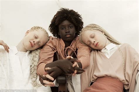 Albino twins from São Paulo become models | Black beauties, Albino ...