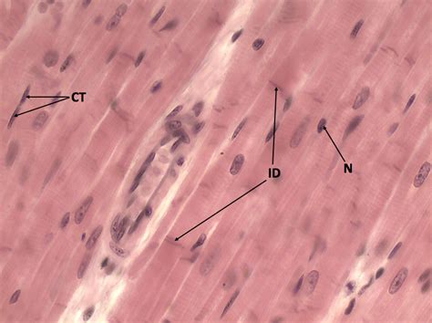 Microscope Cardiac Muscle Cell Labeled - img-stache