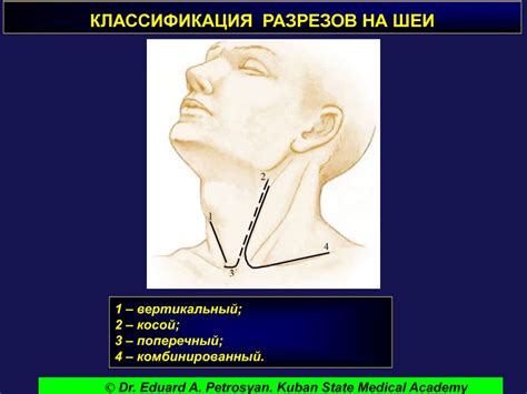 Операции на органах шеи - презентация онлайн