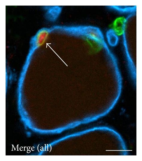 Exogenous satellite cells are formed by the transplantation of human ...