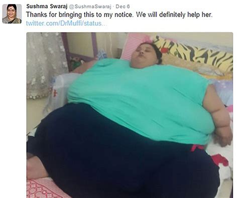 Woman dubbed ‘world's fattest woman' to get operation