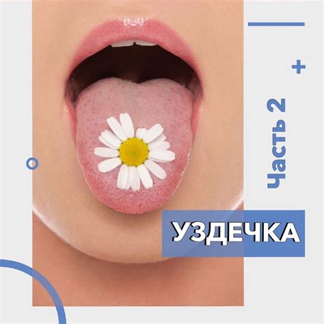 Уздечка языка - стоматология Орбиталь
