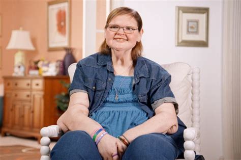 See Tammy Slatons Transformation After Skin Removal Surgery