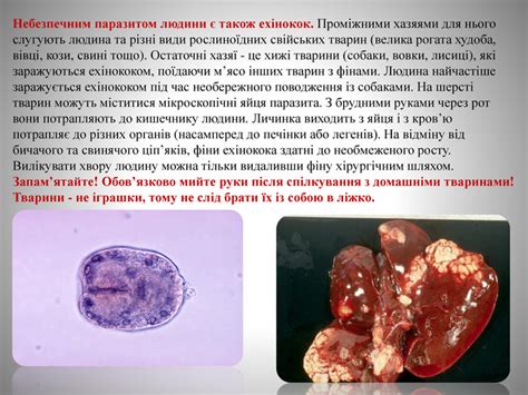 Презентація "Паразитичні черви - гельмінти"