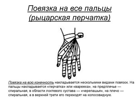Десмургия. Виды повязок - презентация онлайн