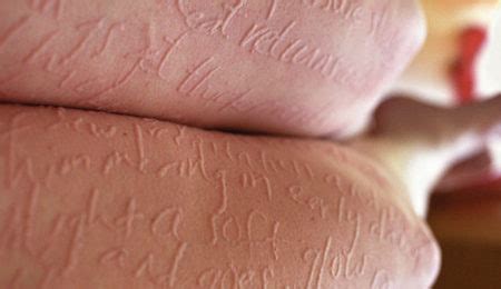 18 Strange Medical Conditions You Wouldn’t Believe Are Real