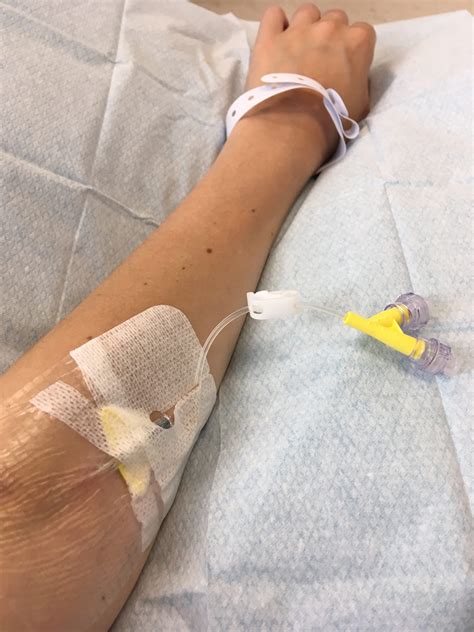 Ferinject Iron Infusion : What You Need To Know - Invisibly Me