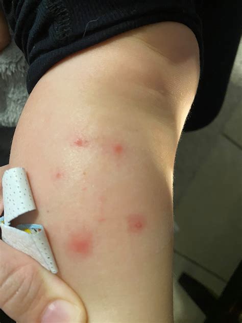 Homeowners Entomology (Insect Identification) | Need help identifying