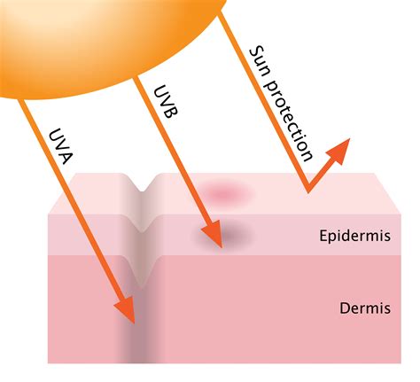 Can One Sunburn Cause Cancer at Alison Mclemore blog