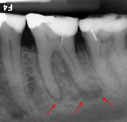 toothache wikipedia