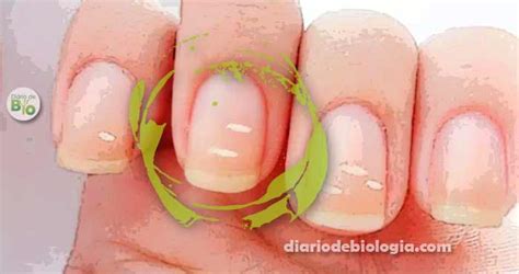 O que são essas manchas brancas que aparecem nas unhas? - Diário de ...