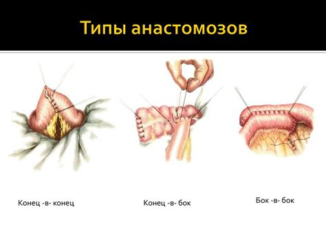 Введение в абдоминальную хирургию - online presentation