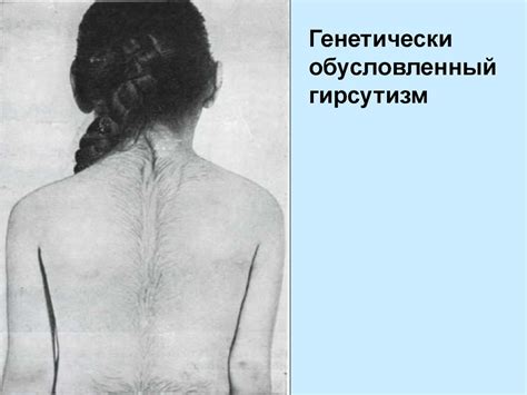 Болезни волос - презентация онлайн