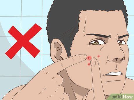 how to heal open sores on baby's bottom