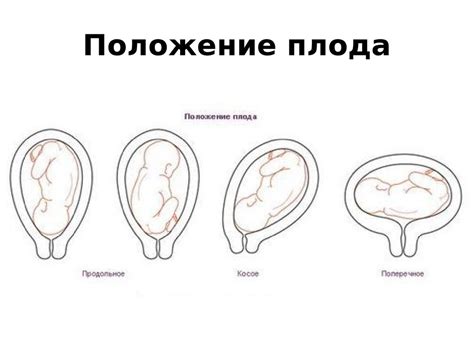 Биомеханизм родов в переднем и заднем видах затылочного вставления ...