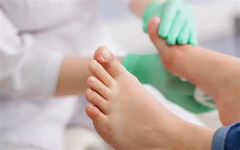 Soigner un ongle incarné