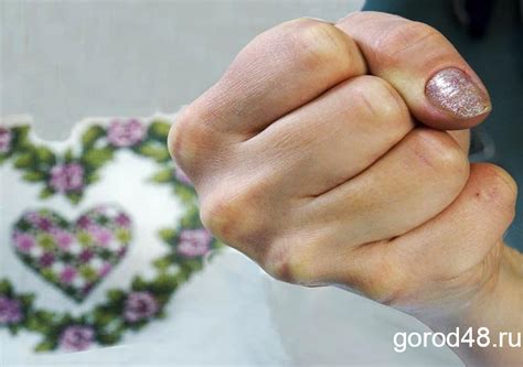 Из-за места в подвале липчанка сломала соседке ногу