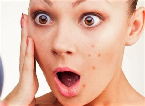 Прыщи на лице за какие органы отвечают: как их лечить?