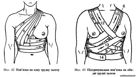 Загальна хірургія - Види пов'язок