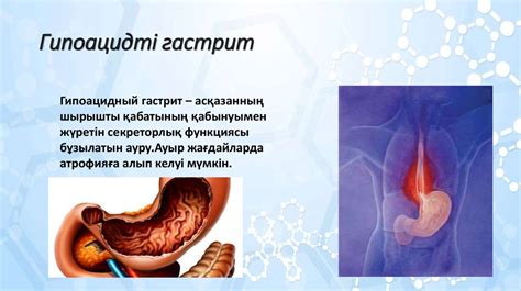 Атрофиялық гастрит гипоацидті гастрит - презентация онлайн