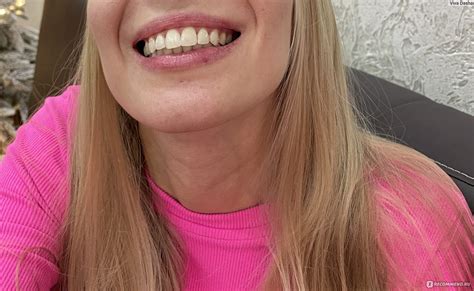Отбеливание зубов по системе zoom - «Отбеливаю белые зубы 🤪 по системе ...