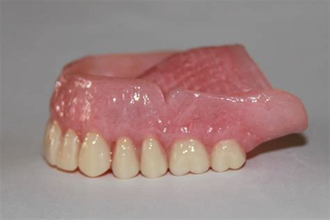 Dentapreg - Dentures