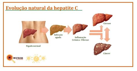 O Que Causa Hepatite C