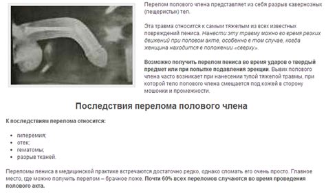 Как лечат перелом полового члена?