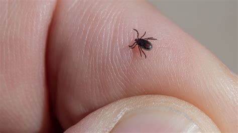 deadly tick borne virus     uk   case detected