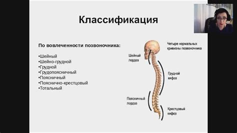 Сколиоз у детей: клиника диагностика лечение (вебинар) - YouTube