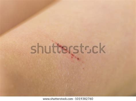 48,678 Skin Scratching Stock Photos, Images & Photography | Shutterstock