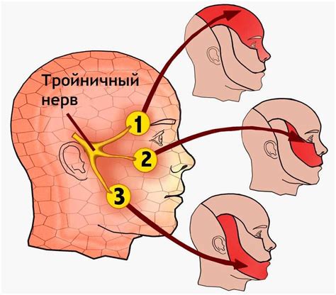 Воспаление тройничного нерва: причины, симптомы, диагностика и лечение