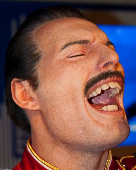 Freddie Mercury Teeth Diagram