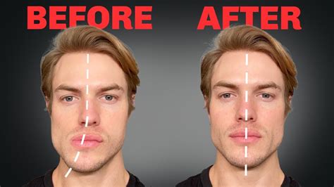 How to Fix Asymmetrical Jaw & Face (FOREVER) - YouTube